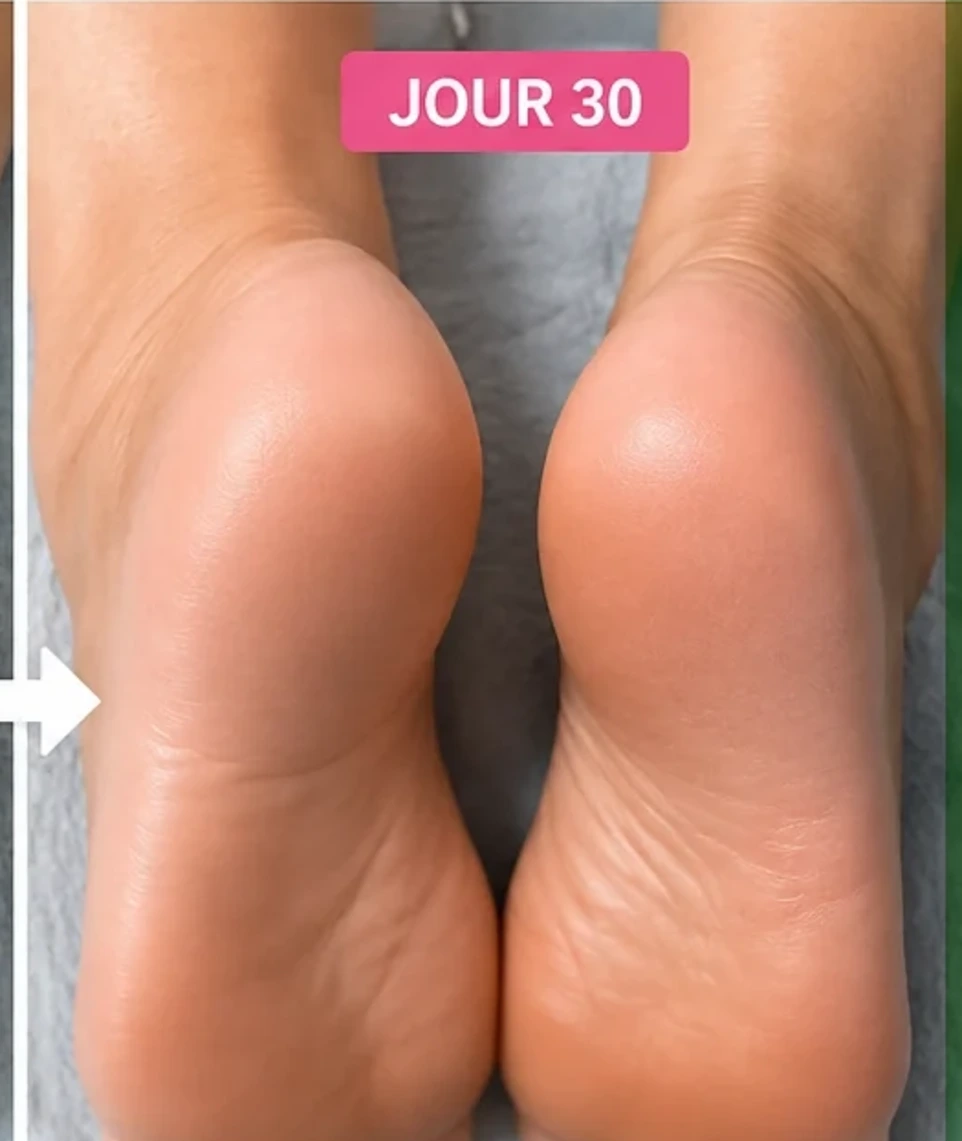 Pieds-sains-hydratés